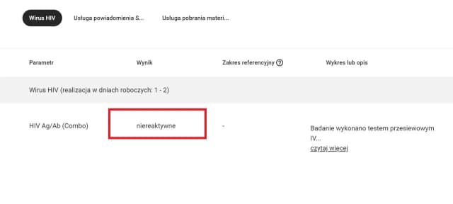Badanie HIV - ile się czeka na wynik? Czas oczekiwania na testy Badanie HIV - ile się czeka na wynik? Czas oczekiwania na testy