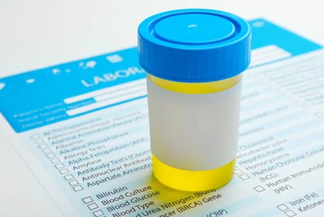 Ile moczu do badania ogólnego? Kluczowe informacje, które musisz znać Ile moczu do badania ogólnego? Kluczowe informacje, które musisz znać