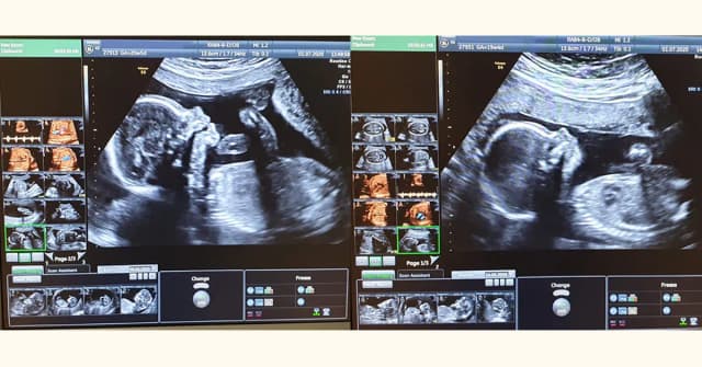 Czy badania prenatalne są obowiązkowe? Poznaj istotne informacje i zmiany. Czy badania prenatalne są obowiązkowe? Poznaj istotne informacje i zmiany.